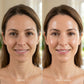 Before and after 4 weeks results