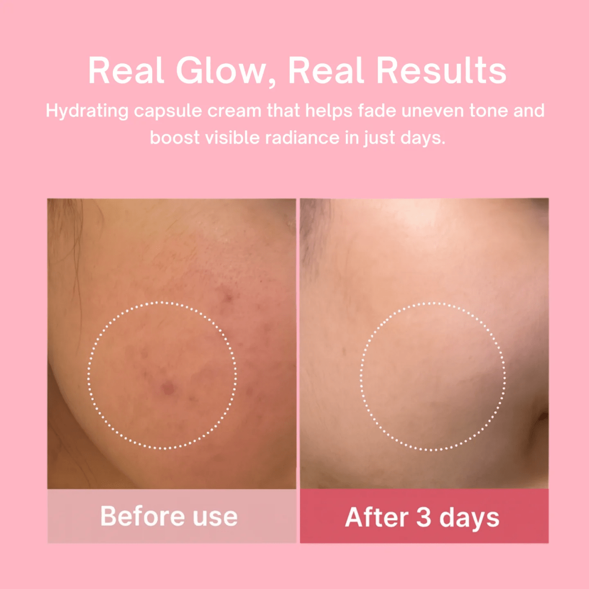 Dermova™ - PDRN + Collagen Capsule Cream - Mishmox